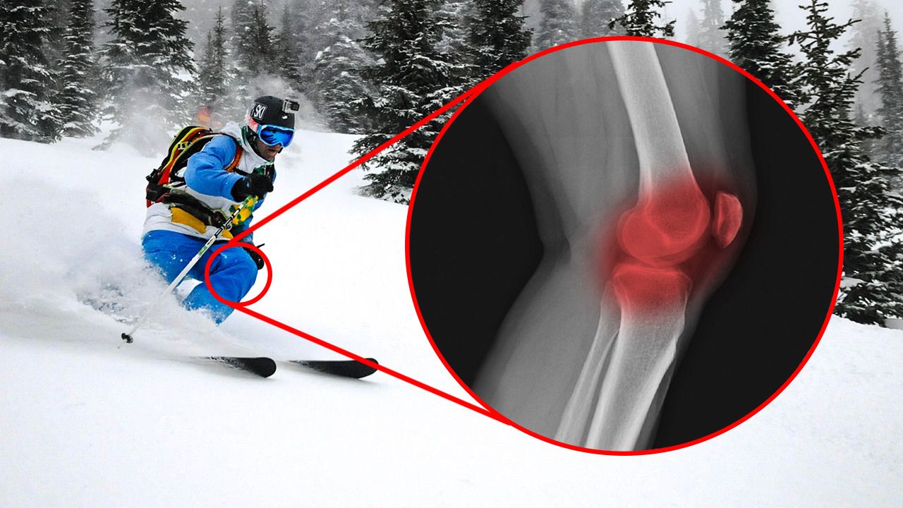 Son los esquís anchos malos para tus rodillas? - 110% SKI - Nevasport.com