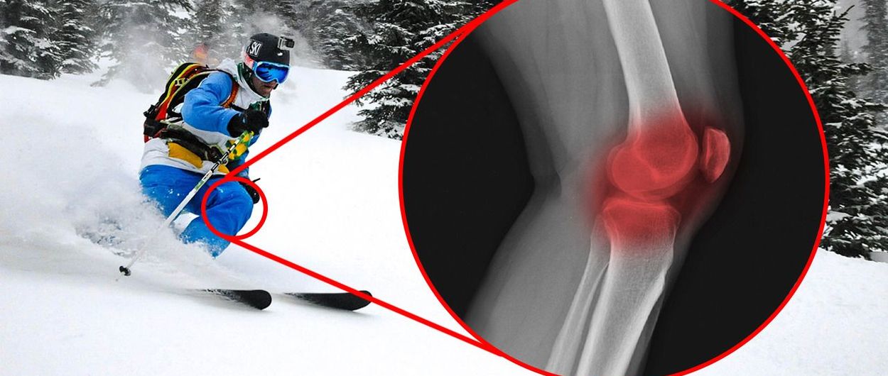 ¿Son los esquís anchos malos para tus rodillas?